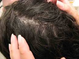 Shampoo your hair and condition it before combing thoroughly. How To Get Rid Of Head Lice Home Remedies For Head Lice