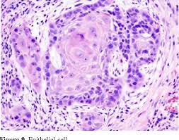 Stem cell biology, ivf technology, cancer cell biology, monoclonal antibody production, recombinant protein production. Pdf An Animal Cell Culture Advance Technology For Modern Research Semantic Scholar