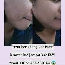 Lela salon nie bagusnya ade tirai utk separate kan wanita. Cantik Bersama Muslimah Beauty No 16a Jalan P9b 1 Presint 9 Putrajaya 2021