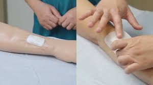 Image result for Wound Dressing