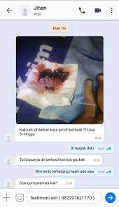 Maybe you would like to learn more about one of these? Obat Aborsi Cytotec 400mcg Rekomendasi Terbaik Untuk Menggugurkan Kandungan Kuat Ministry Of Education