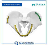 FAP Iliopubic Anterior Column Anatomic Locking Plate ...