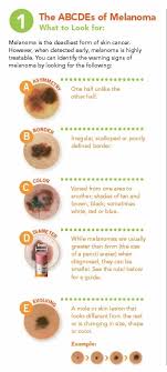 And melanoma often begins on skin that looks perfectly normal. Malignant Melanoma Dermatology Specialists
