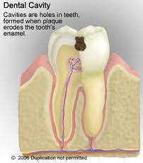 A dental hygienist career requires minimal schooling; What Does A Dental Hygienist Do And Do I Really Need To Go Blue Court Dental Centre Harrow