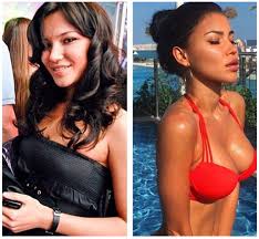 Instagram Girls Before Plastic Surgery Irina Tee Plastic Surgery Plastic Surgery Photos Celebrity Plastic Surgery