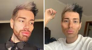 Hij geeft $70.000 uit aan cosmetische chirurgie om zoveel mogelijk op Ken  te lijken: "Het is het waard"