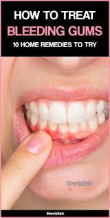 How To Treat Bleeding Gums 10 Home Remedies To Try Bleeding Gum Gum Home Remedies