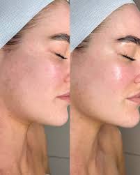 Slay the shade this summer with our limited edition Glo Cap in butter. Shop  online or in clinic.