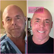 Does Scott resemble Bruce Willis after his facelift?