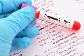 The second number measures the pressure in your arteries between beats (when your heart is relaxed and filling with blood), and is called diastolic. Normal Troponin Levels What High Levels Mean Plus Causes