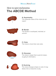 Because many skin cancers develop where they can be seen, there is a good chance of catching them early. Skin Cancer Symptoms Types And Warning Signs