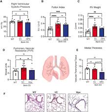 Targeting lung heme iron by aerosol hemopexin adminstration in sickle cell  disease pulmonary hypertension