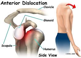 Your upper arm bone (humerus), your your arm is kept in your shoulder socket by your rotator cuff. Shoulder Instability Brisbane Knee And Shoulder Clinic Dr Macgroartybrisbane Knee And Shoulder Clinic