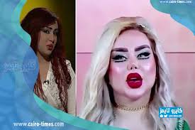 نتحدث عن كل التساؤلات عن هذه العملية. Ù…Ù„ÙƒØ© ÙƒØ§Ø¨Ù„ÙŠ ÙˆØ²ÙˆØ¬Ù‡Ø§ Ù‚Ø¨Ù„ Ø¹Ù…Ù„ÙŠØ§Øª Ø§Ù„ØªØ¬Ù…ÙŠÙ„