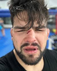 Before/after #illbeback #soon #OnaMission4Gold