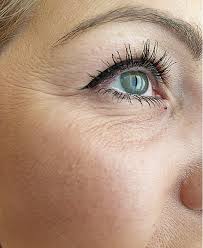 How to get rid of eyelid creases. Bac