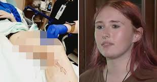 Florida Woman Recovering After Alligator Attack