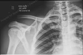 Image result for AC Dislocation