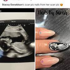 Ultrasound Nail Art Is The Hot New Thing So Your Fingers Can Be Pregnant Too