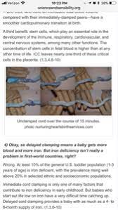 Delayed Cord Clamping August 2018 Babies Forums What To Expect