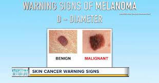 In other words, about 20% of peo. Can You Spot Skin Cancer Keep An Eye Out For These Warning Signs