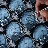 Why study the brain? - Queensland Brain Institute ...