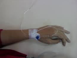 Bagi anda yang sedang mengurangkan berat badan, air kelapa tidak selain itu, kandungan elektrolit yang mencukupi dalam air kelapa berupaya mengimbangi kandungan elektrolit dalam badan. Orang Lain Muntah Muntah Dan Cirit Birit Aku Yang Demam Kena Masuk Wad Hu Dastorybegins