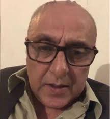 As David Beckham steps out with a suspiciously thicker thatch, these men  reveal their hair transplant hell