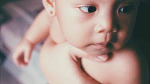 Caranya yaitu siapkan kubis lalu haluskan menggunakan blender. Memahami Bercak Putih Pada Kulit Bayi Kumparan Com