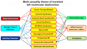 Heart Arrhythmias - Physiopedia