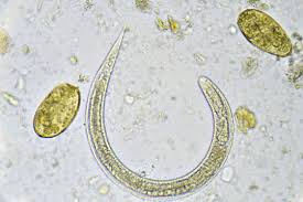 Image result for Strongyloides