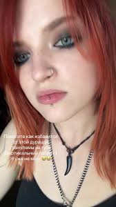 Шишка На Губе Внутри Прокола