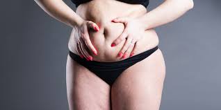 Seeing as i gained 3 stone each time i'm wondering Tummy Tuck The Procedure Of Removing Excess Skin Fat For Those Who Want A Toned Contoured Abdomen