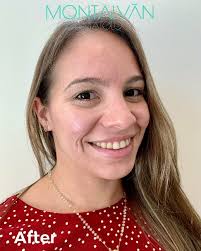 Montalván Dermatology