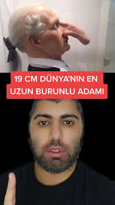 Dünyanın En Uzun Burunlu Adamı: 19 Santim