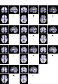 Starting from 10am tomorrow (23 mac 2011) till 30 mac 2011, you can check your result by sending the sms: Group Level 2 Fmri Data Analysis Bob Spunt Phd