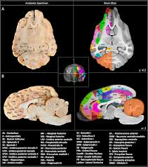 Specific groups of them, working in concert, provide us with the capacity. Stereotactic Cortical Atlas Of The Domestic Canine Brain Scientific Reports