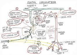 Image result for Delayed Transition from Fetal Circulation