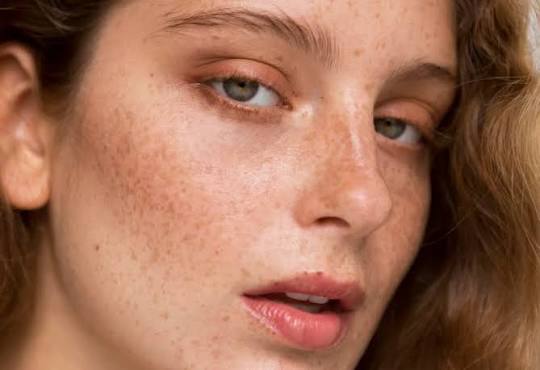 dark spots cream