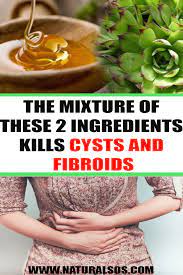 The Mixture Of These 2 Ingredients Kills Cysts And Fibroids Fibroids Fibroids Treatment Cysts
