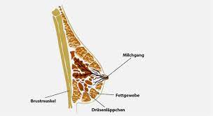 Brustkrebs Mammakarzinom