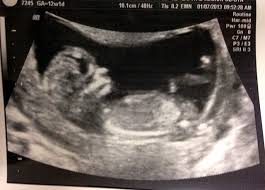 We did a deep dive on what to expect on the plane and in the airport during coronavirus. What To Expect At 12 Week Prenatal Appointment