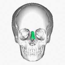 The frontal bone, parietal bone, occipital bone, temporal bone, sphenoid bone, and ethmoid bones contribute together to form a total of 8 cranial bones. Facial Skeleton Physiopedia