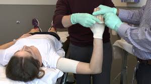 Image result for Long Arm Cast
