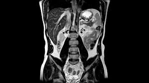 Abdominal mris are used for a variety of reasons, such as examining: Mri Make Software Change The World Computer History Museum