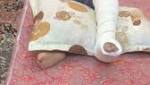 علاج لطفل في مستشفى بتبوك