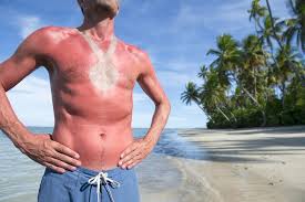 Find out how to protect your skin. Sunburn Relief How A Dermatologist Soothes And Heals Itchy Red Skin