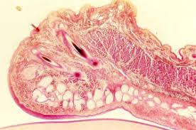 Merkel cell carcinoma (mcc) is a rare, aggressive neoplasm, which commonly involves the skin, but can subsequently to lymph nodes and other organs merkel cell carcinoma (histology). Basic Histology Of The Eye And Accessory Structures Eyewiki