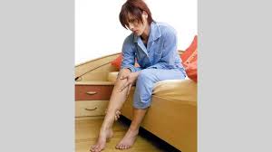 ما هى دوالى الساقين ؟! Ø¯ÙˆØ§Ù„ÙŠ Ø§Ù„Ø³Ø§Ù‚ÙŠÙ†