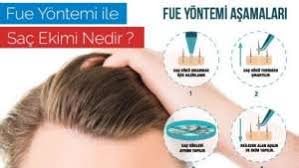 Fue Sac Ekimi Alanya Euromed Estetik Ve Sac Ekim Klinigi Dr Aydogan Yigit